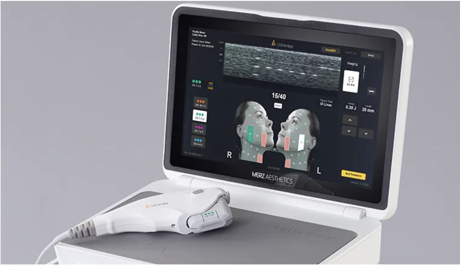 Oblasti ošetření Ultherapy Prime